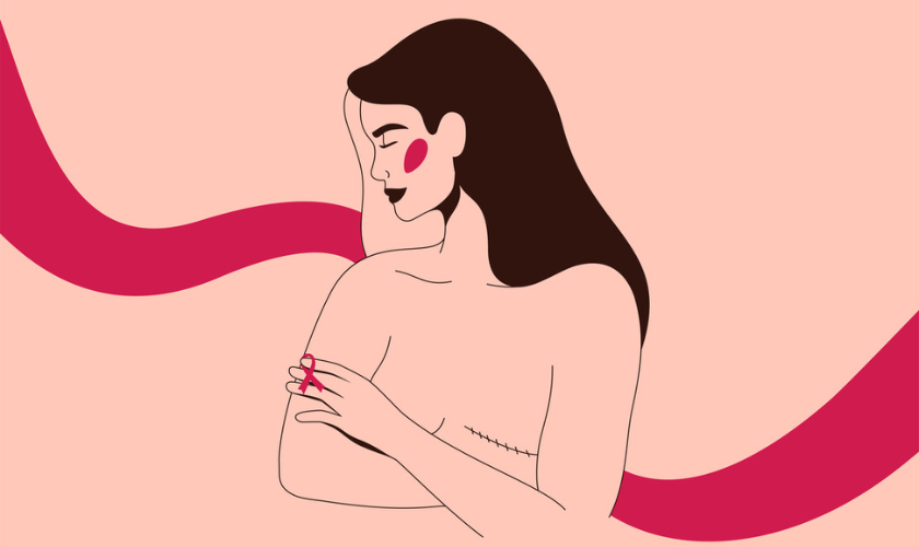 telo posle karcinoma